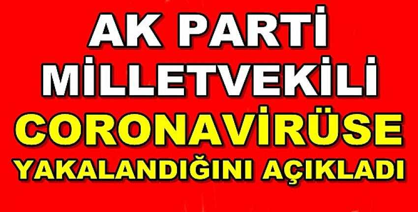 Ak Parti Milletvekili Coronavirüse Yakalandı