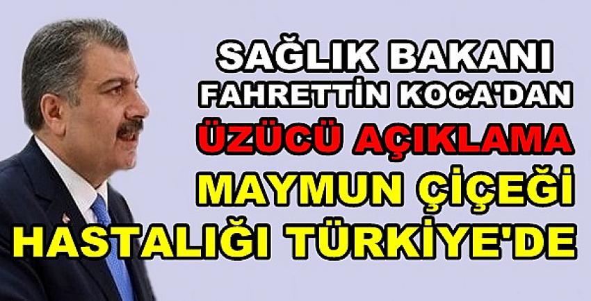 Bakan Koca: Türkiye'de Maymun Çiçeği Vakası Görüldü  